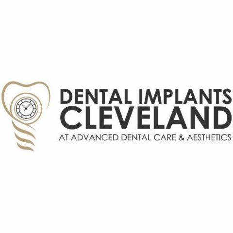 Dental  Implants 