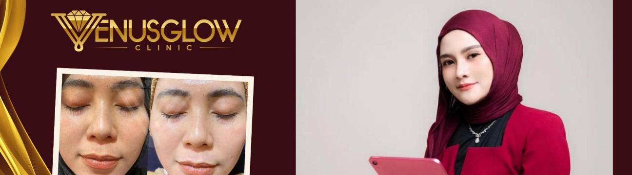 Venus Glow  Clinic